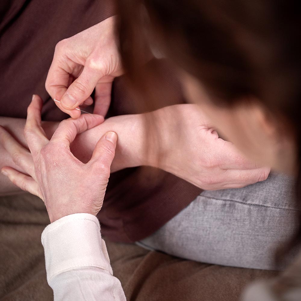 acupunctuur-naaldinarm-yinjansacupunctuur