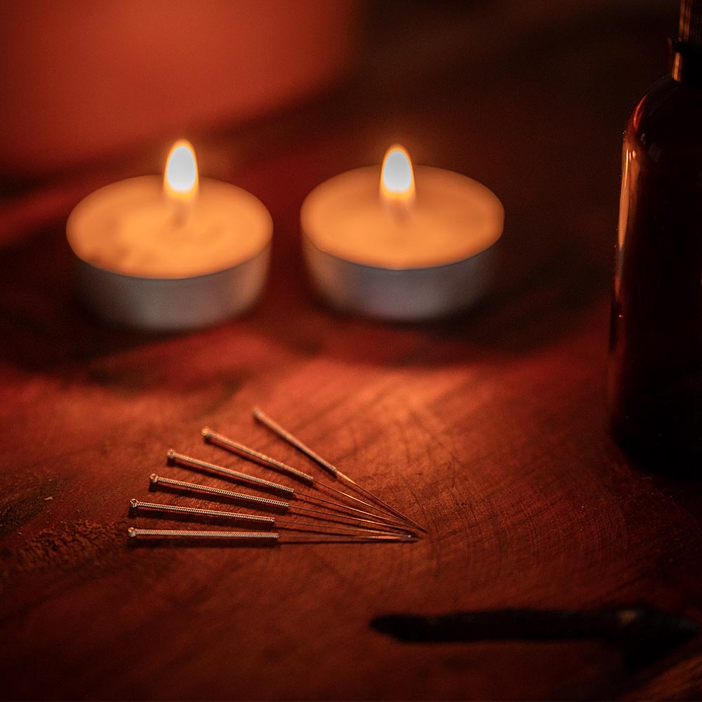 hersteldeflow-yinjansacupunctuur