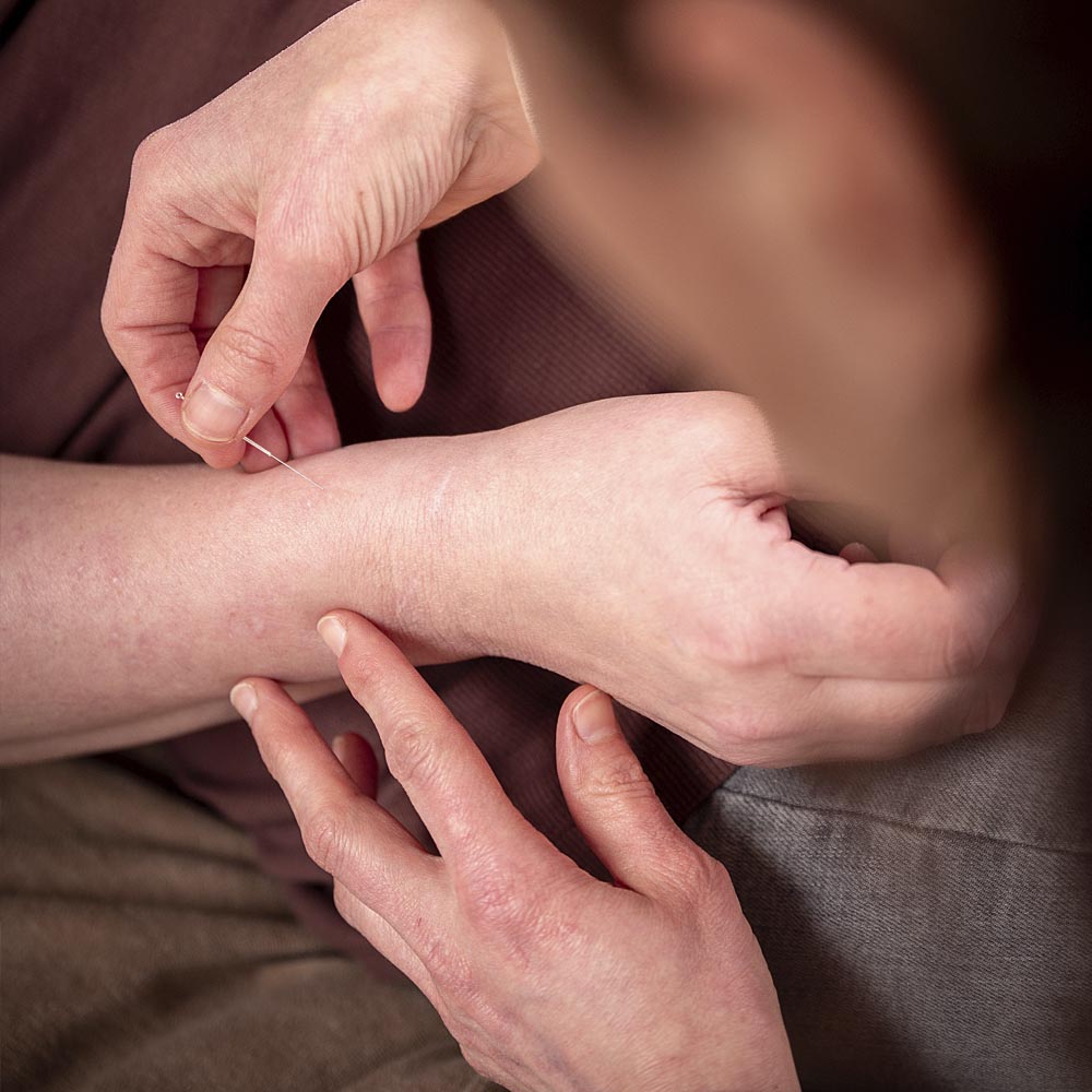 home-acupunctuur-yinjansacupunctuur